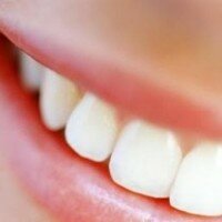 denti bianchi