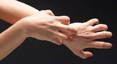 perchè grattandosi passa il prurito